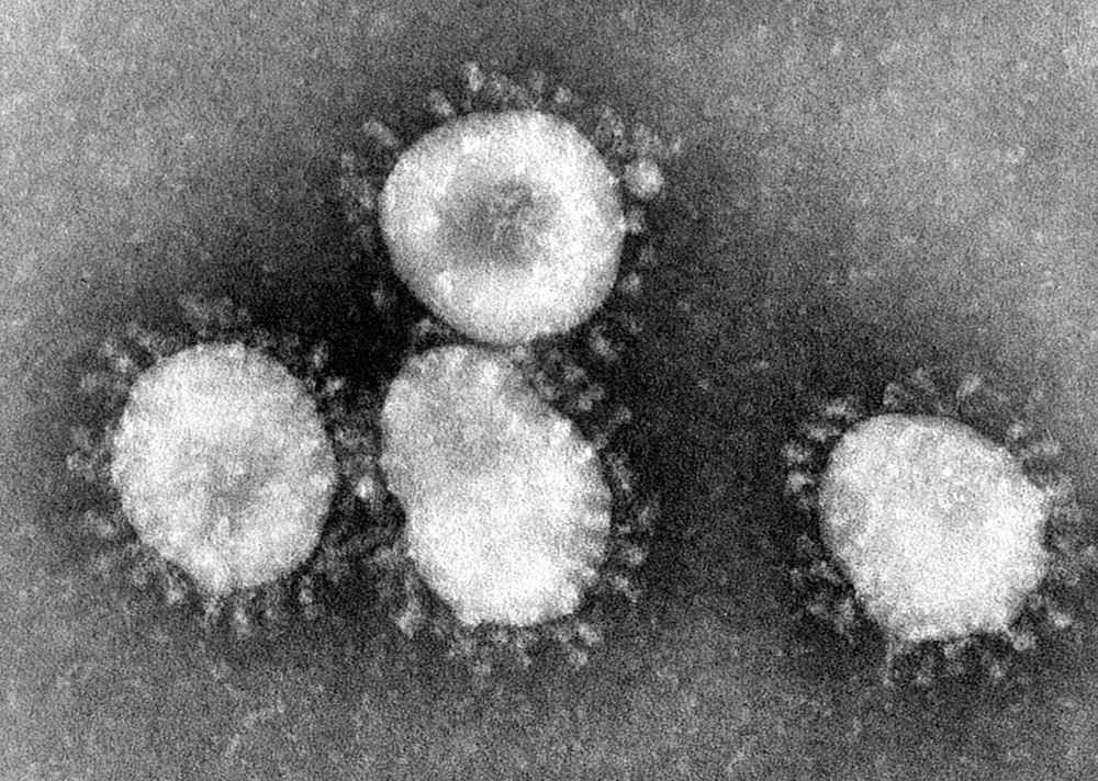 SARS outbreak prompts significant public health measures in Canada.