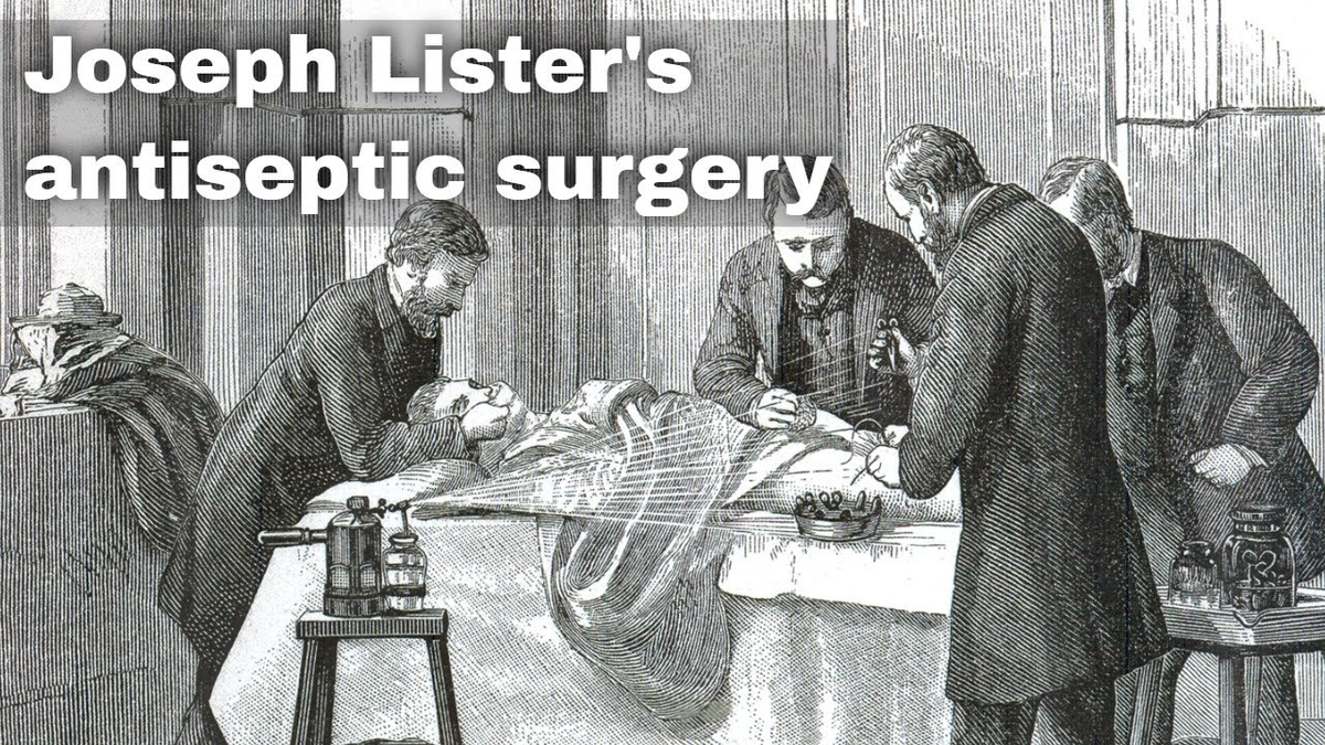 Moment image for Introduction of Antisepsis in Wound Treatment