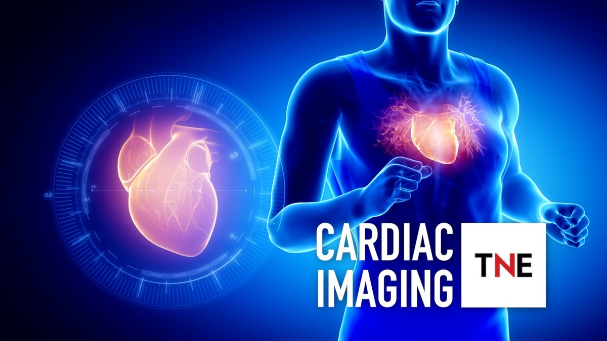 Moment image for Philips Expands Image-Guided Therapy with Volcano Acquisition